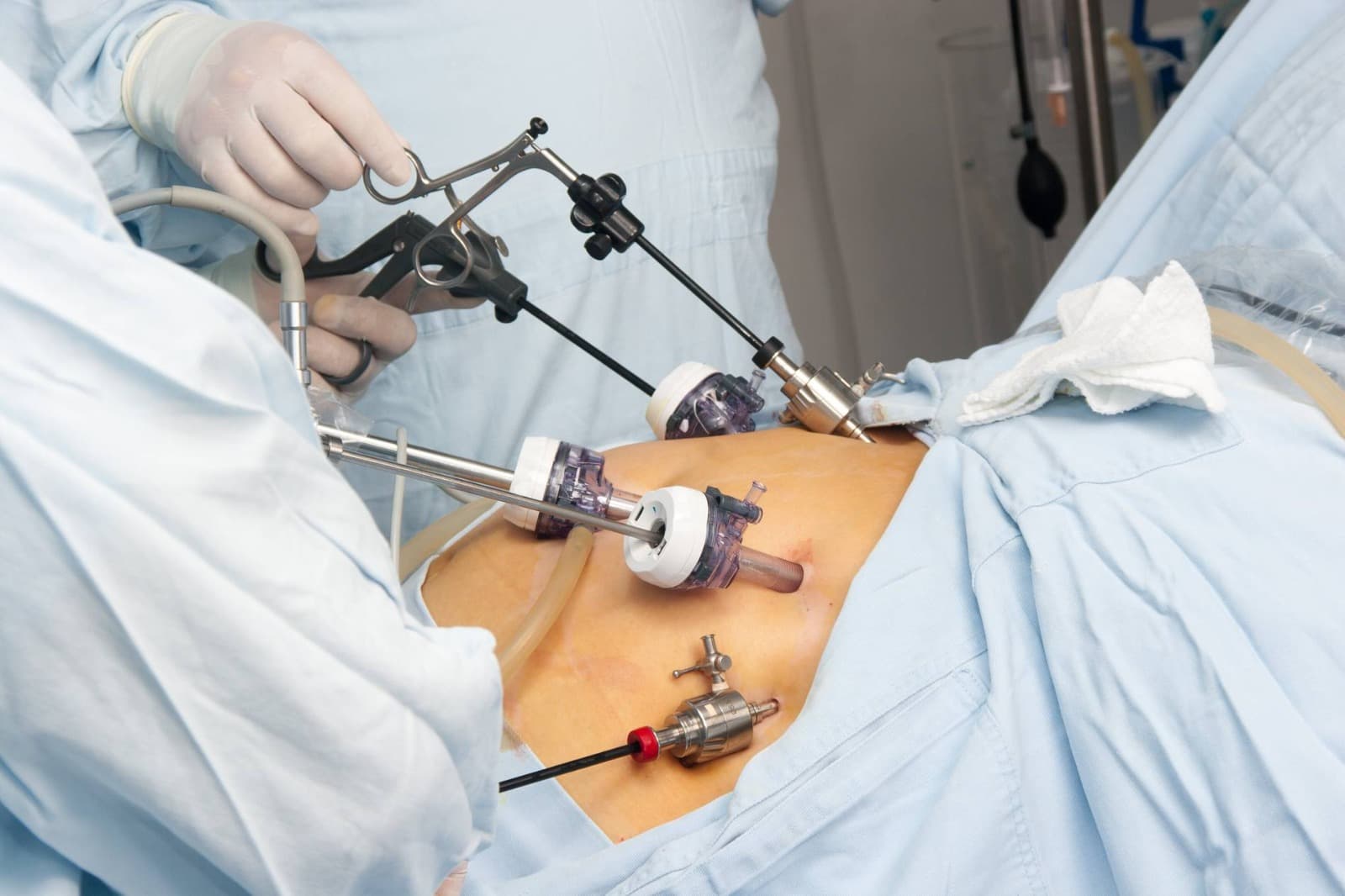 Magenverkleinerung Türkei beste Klinik: Vertrauen Sie auf Erfahrung, Sicherheit und exzellente Betreuung