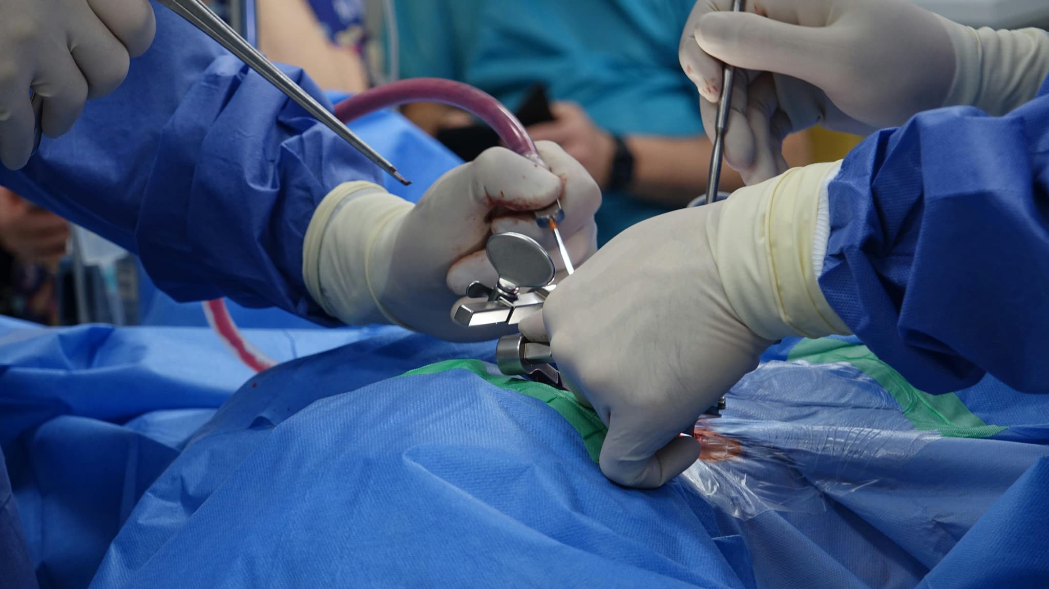 Affordable Cosmetic Surgery Turkey Options for Every Patient