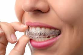Why Wearing a Retainer After Braces Is Important